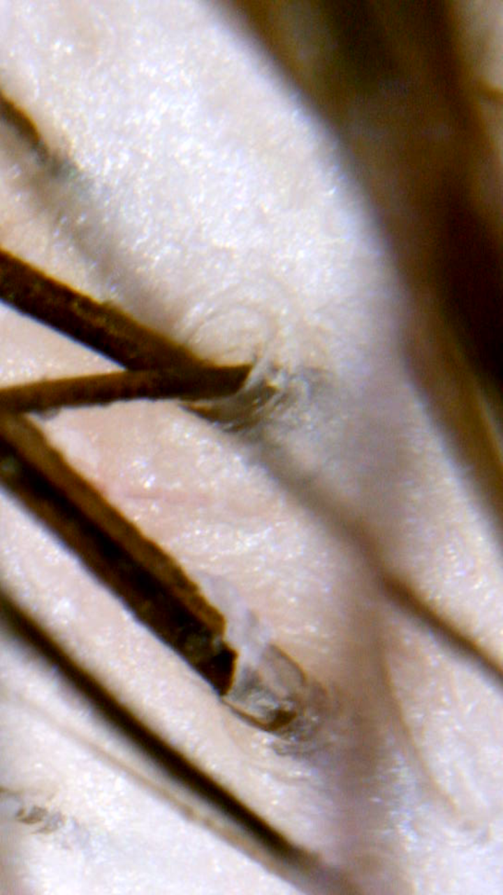 Magnified view of hair and scalp through Nadine's professional scope